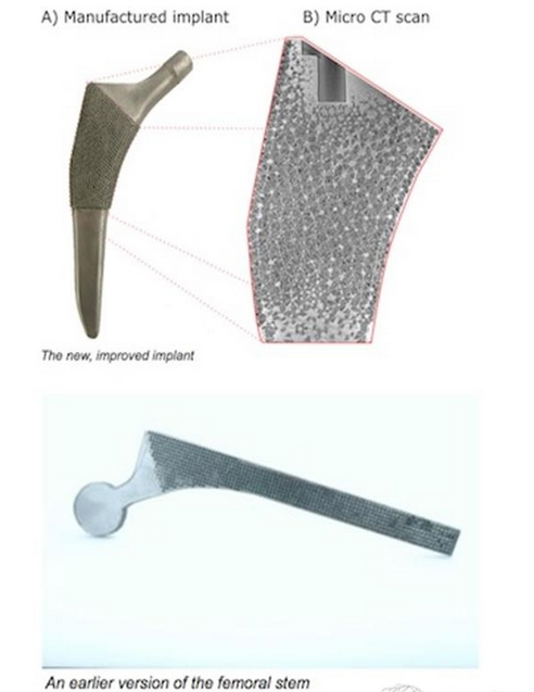 MicGill大学推出接近天然骨的多孔3D打印骨骼植入物国外新闻3D虎